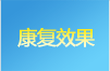 GX-B��ά���翵�����̿���Ч��